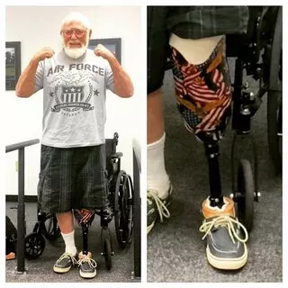 Prosthetic Solutions of Indiana
