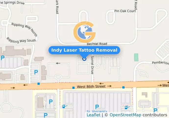 Indy Laser Tattoo Removal