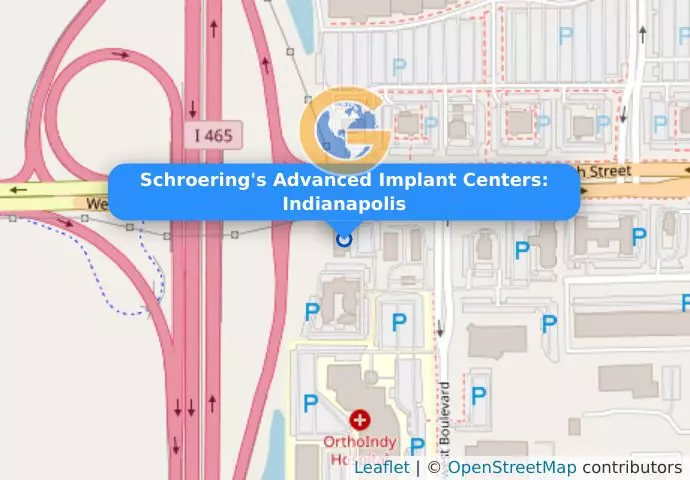 Schroering&apos;s Advanced Implant Centers: Indianapolis