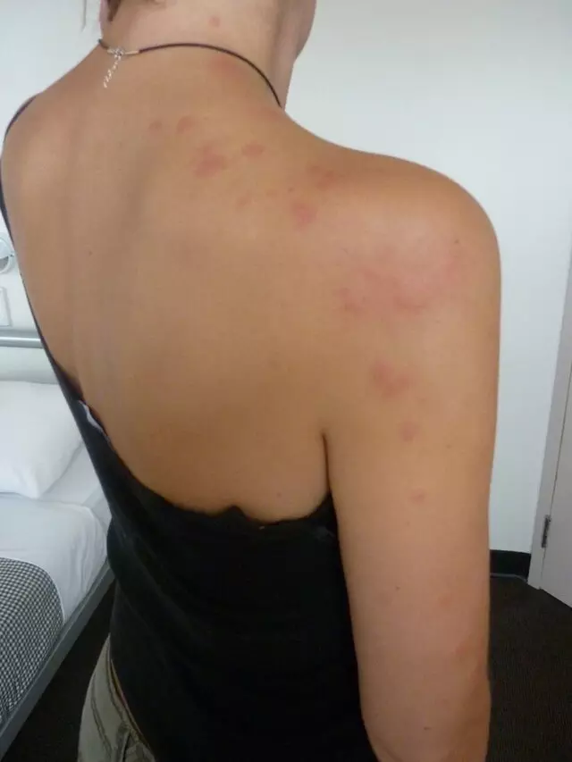 The Bed Bug