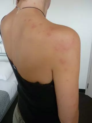 The Bed Bug