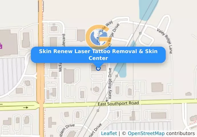 Skin Renew Laser Tattoo Removal & Skin Center